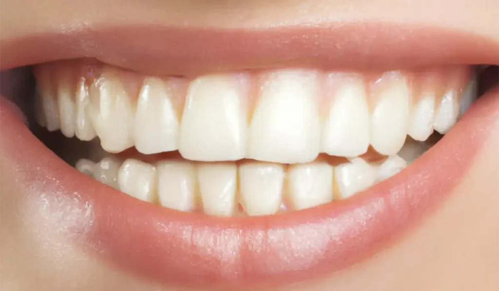 Clean teeth showing results of oil pulling benefits