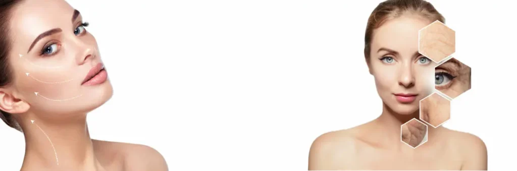 Anti-Wrinkle Treatments results
