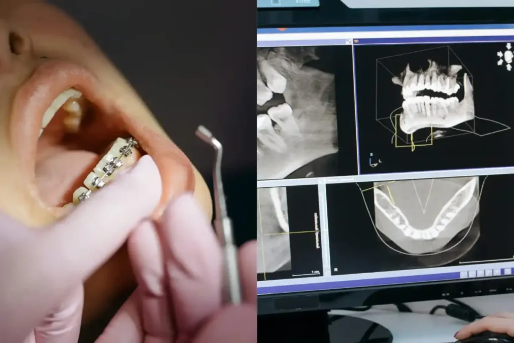 Orthodontist treatment