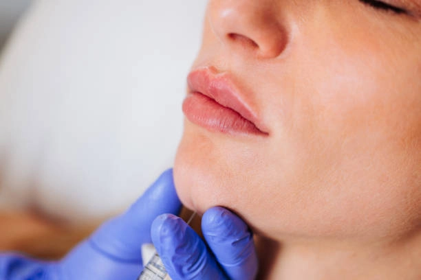 Chin Filler Treatments in Enfield, Southgate & North London