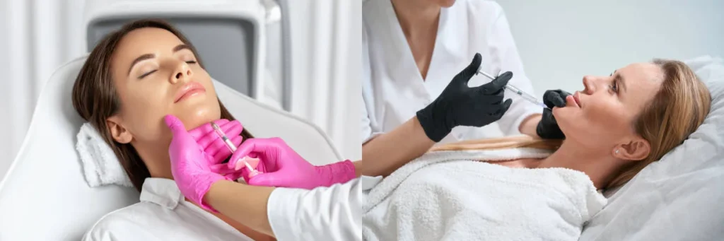 women getting chin filler injection