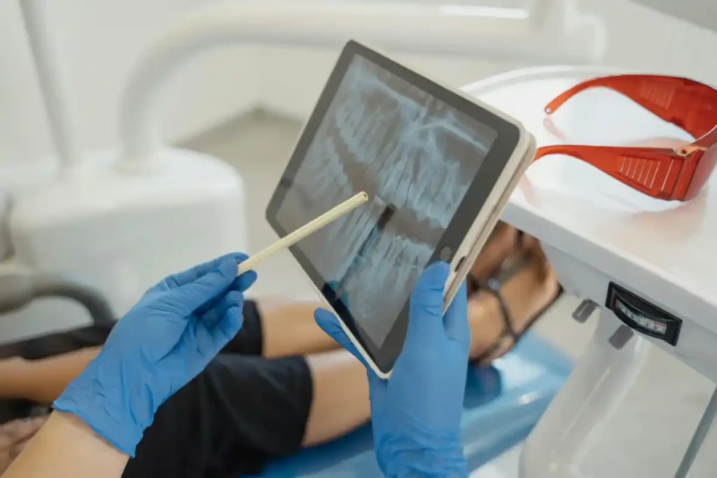 Dental X-ray showing treated canal
