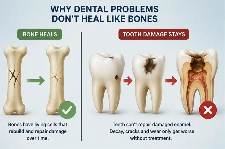Illustration showing how bones can heal naturally while tooth enamel cannot regenerate