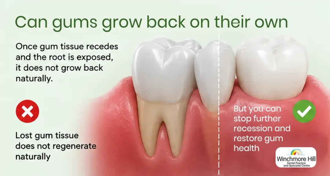 graphics showing comprehensive details about Can Gums Grow Back or not