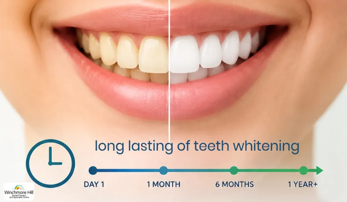 long lasting teeth whitening