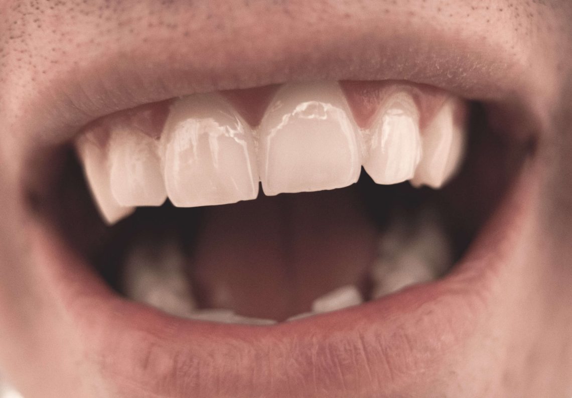 mouth-and-teeth-close-up-1-scaled